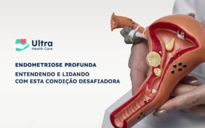 Endometriose Profunda: Entendendo e lidando com esta condição desafiadora.